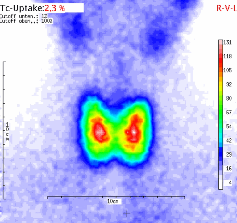 Link zur Leistung Nuklearmedizin