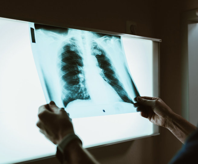 Link zur Leistung Digitales Röntgen