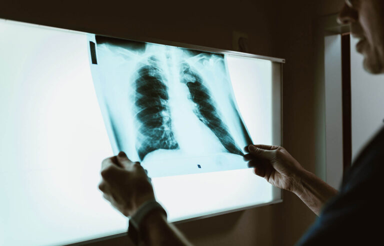 Leistung Digitales Röntgen öffnen